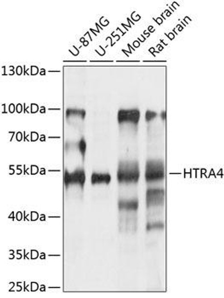 Anti-HTRA4 Antibody (CAB14314)