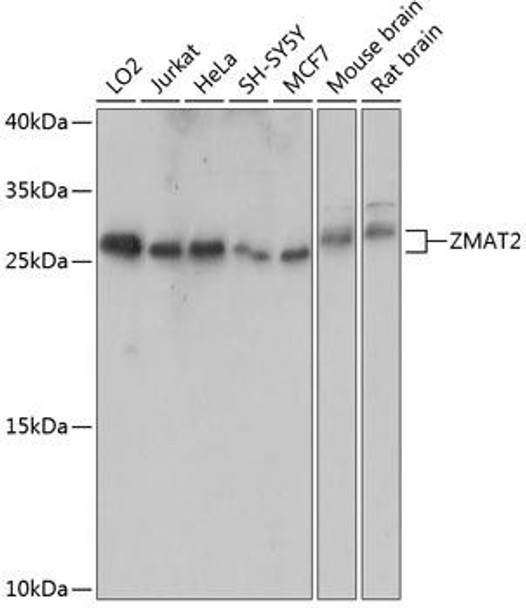 Anti-ZMAT2 Antibody (CAB14354)