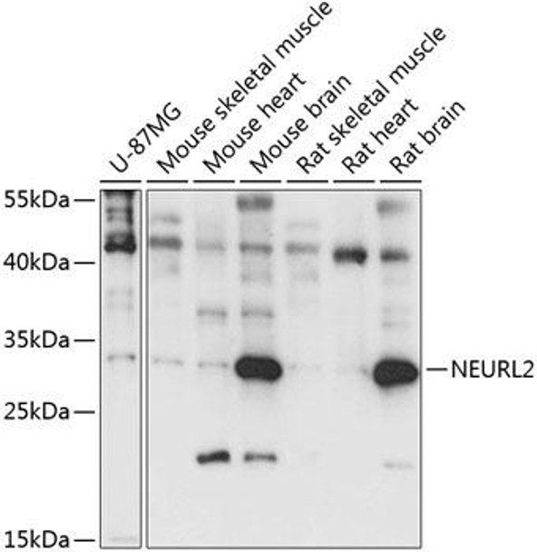 Anti-NEURL2 Antibody (CAB14450)