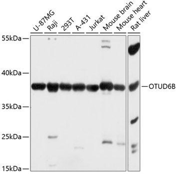 Anti-OTUD6B Antibody (CAB14511)