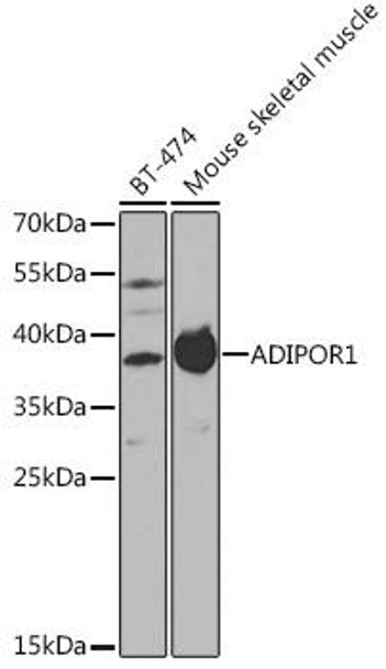 Anti-ADIPOR1 Antibody (CAB1509)