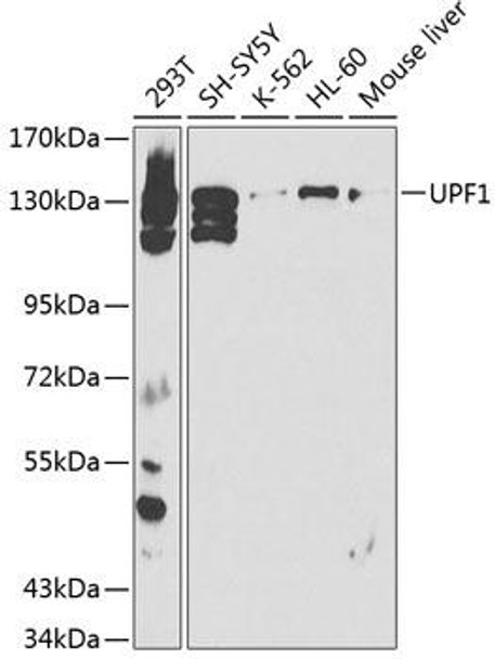 Anti-UPF1 Antibody (CAB1521)