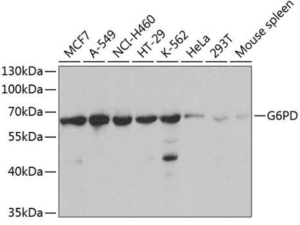 Anti-G6PD Antibody (CAB1537)