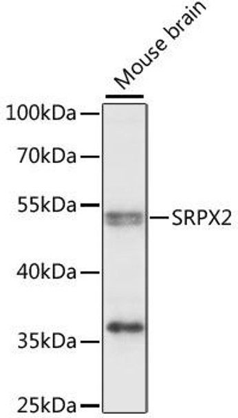 Anti-SRPX2 Antibody (CAB15434)