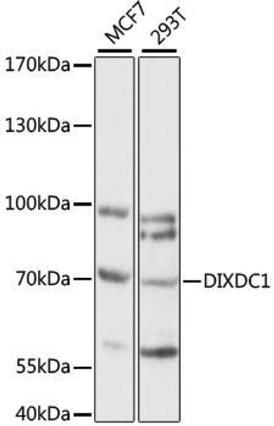 Anti-DIXDC1 Antibody (CAB15542)