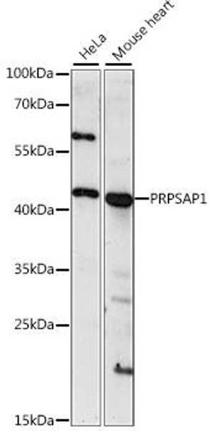 Anti-PRPSAP1 Antibody (CAB15710)