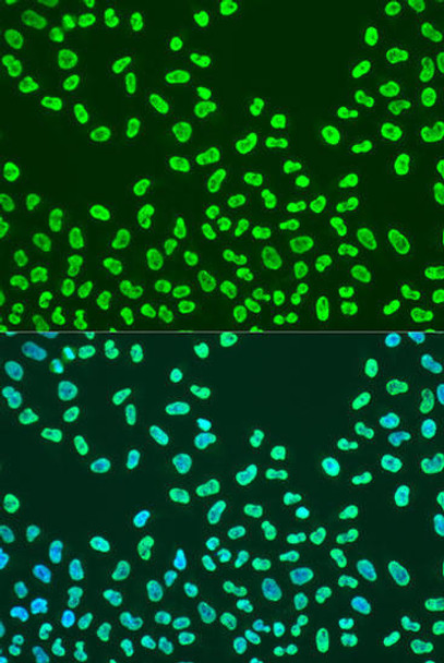 Anti-KHDRBS2 Antibody (CAB15969)