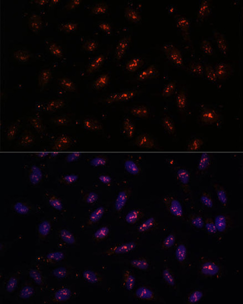 Anti-DNTTIP2 Antibody (CAB16120)