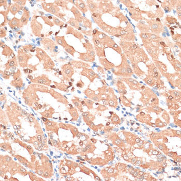 Anti-HMGA1 Antibody (CAB1635)