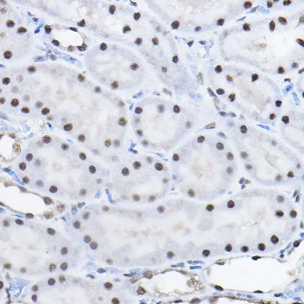 Anti-BCAS2 Antibody (CAB4398)