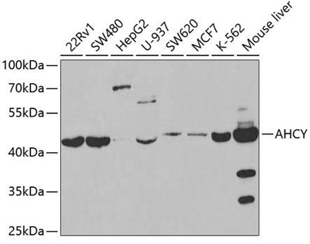 Anti-AHCY Antibody (CAB5300)