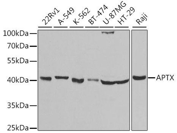 Anti-APTX Antibody (CAB5364)