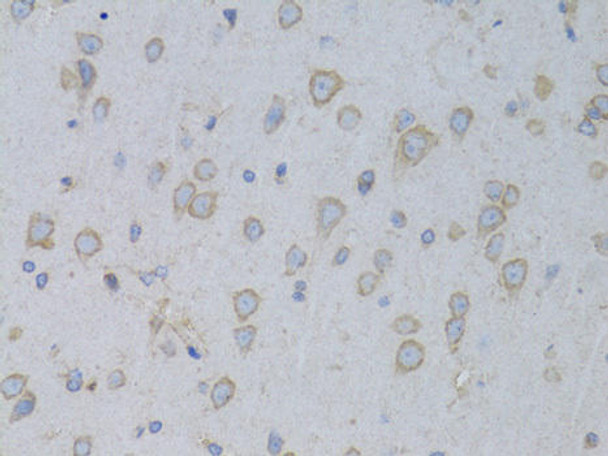 Anti-GARS Antibody (CAB5435)