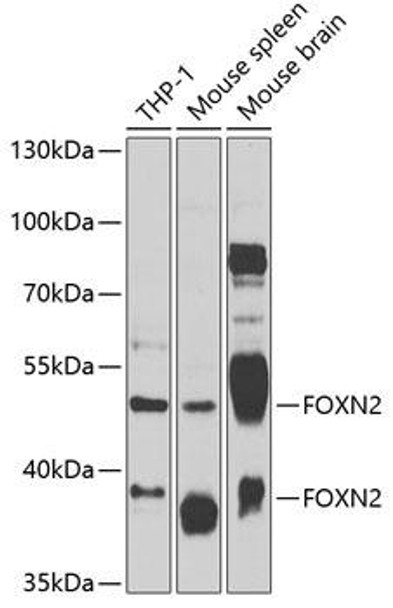 Anti-FOXN2 Antibody (CAB7185)