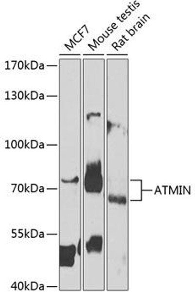 Anti-ATMIN Antibody (CAB7272)