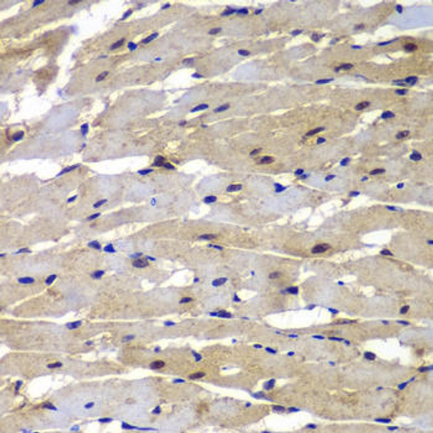 Anti-PSMB8 Antibody (CAB7340)