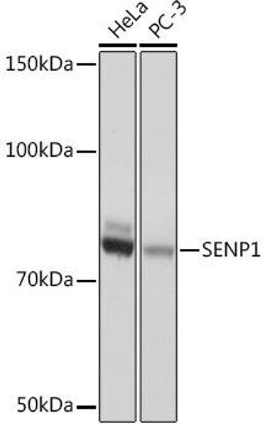 Anti-SENP1 Antibody (CAB4460)