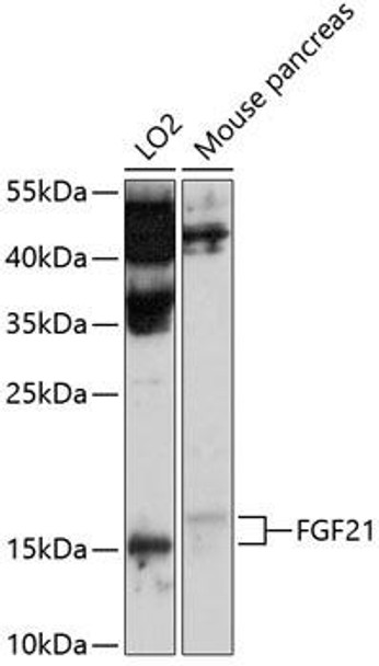 Anti-FGF21 Antibody (CAB10368)