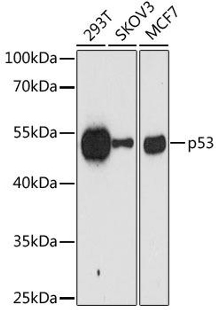 Anti-p53 Mouse Monoclonal Antibody (CAB10610)