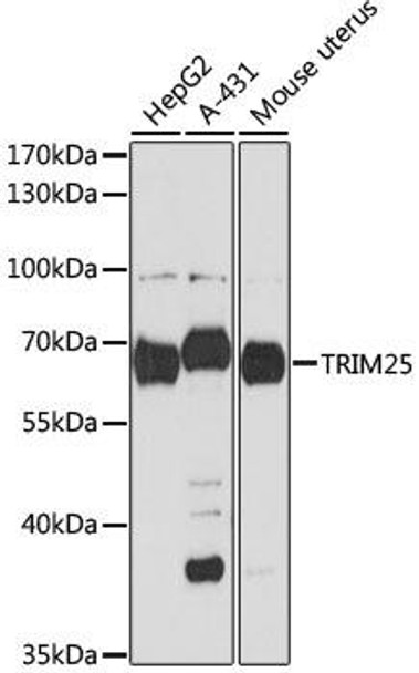 Anti-TRIM25 Antibody (CAB12938)