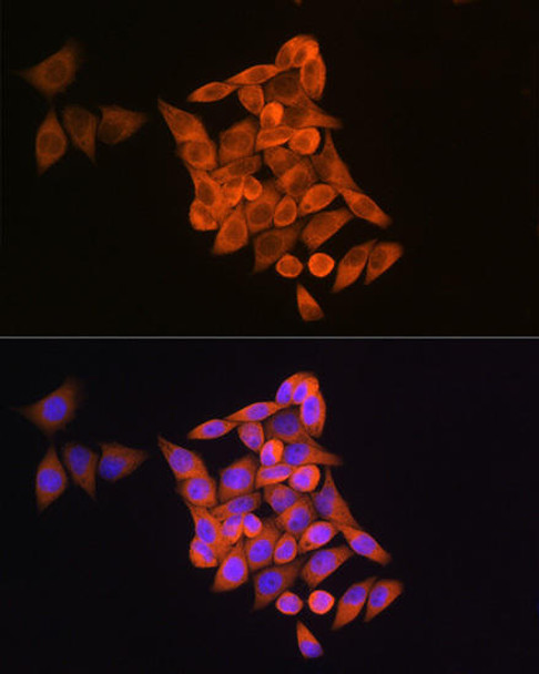 Anti-RRM1 Antibody (CAB13348)