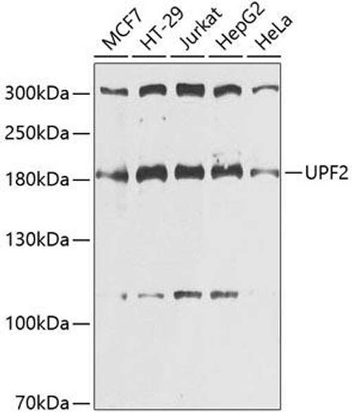 Anti-UPF2 Antibody (CAB13411)