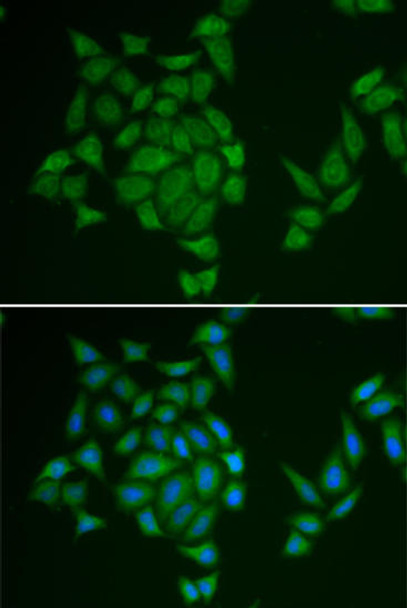 Anti-AMPD3 Antibody (CAB13464)