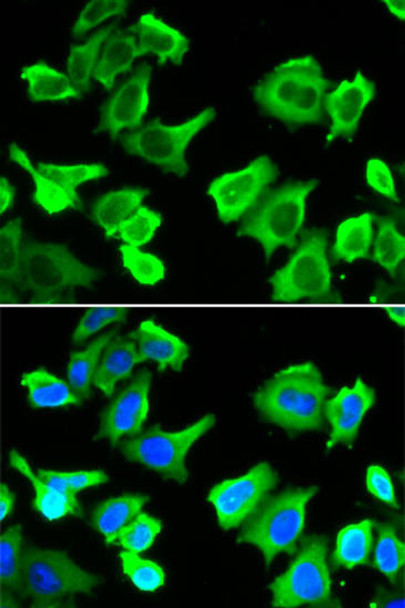 Anti-HSPB1 Antibody (CAB13681)