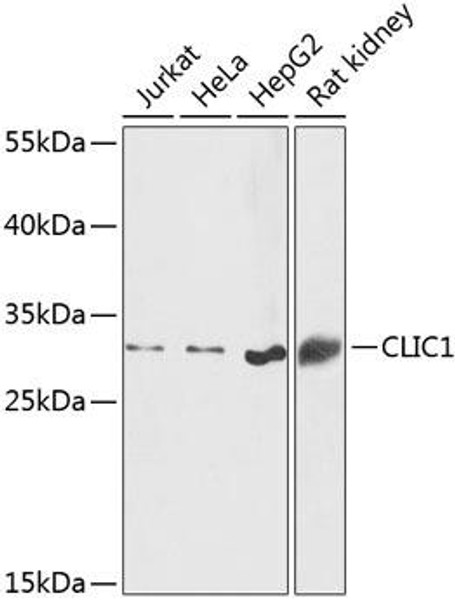 Anti-CLIC1 Antibody (CAB13684)