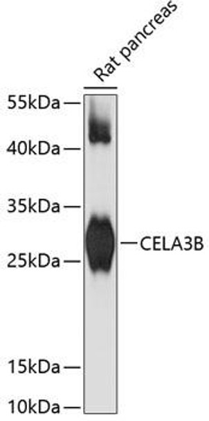 Anti-CELA3B Antibody (CAB13714)