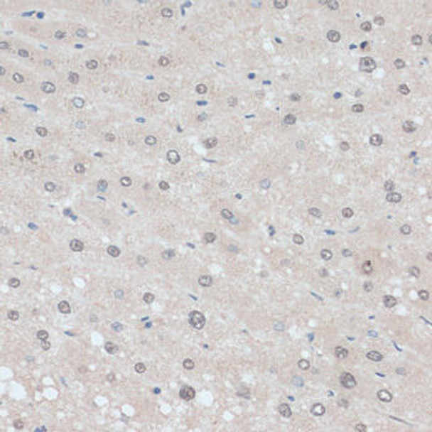 Anti-ZNF707 Antibody (CAB13737)