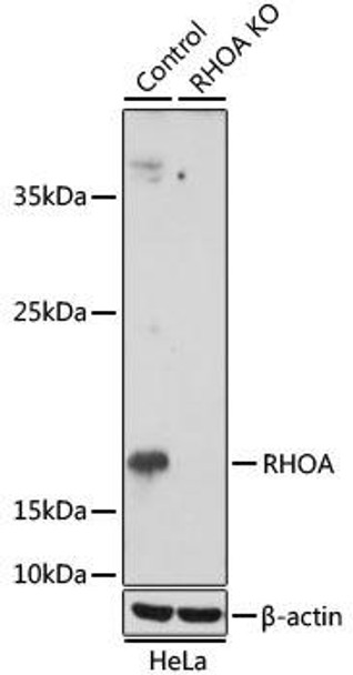 Anti-RHOA Antibody (CAB15641)[KO Validated]