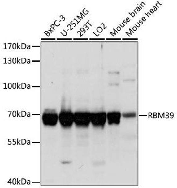 Anti-RBM39 Antibody (CAB15760)