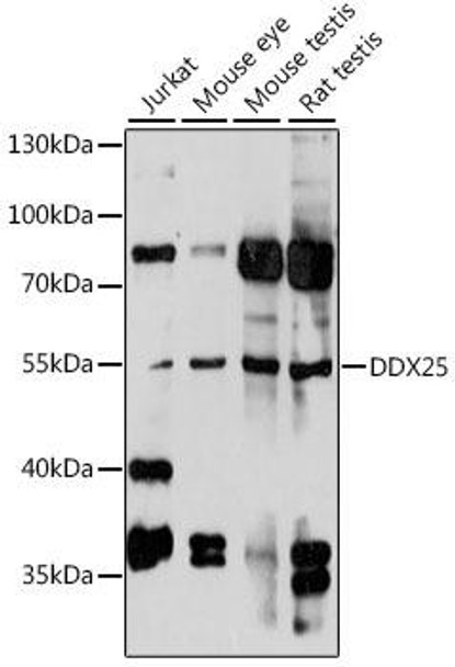 Anti-DDX25 Antibody (CAB15824)