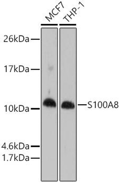 Anti-S100A8 Antibody (CAB1688)