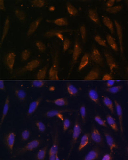 Anti-RAB8A Antibody (CAB17369)