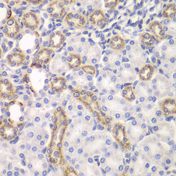 Anti-KEAP1 Antibody (CAB1820)