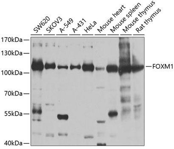 Anti-FOXM1 Antibody (CAB2493)