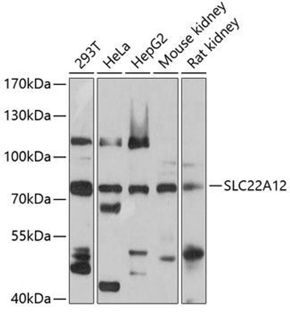 Anti-SLC22A12 Antibody (CAB5118)