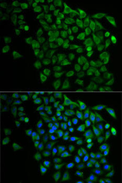 Anti-NDEL1 Antibody (CAB5776)