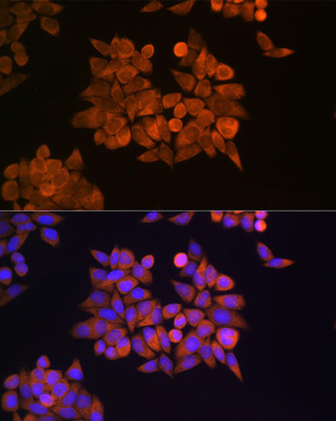 Anti-ETF1 Antibody (CAB5920)