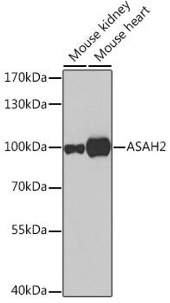 Anti-Neutral ceramidase Antibody (CAB7985)