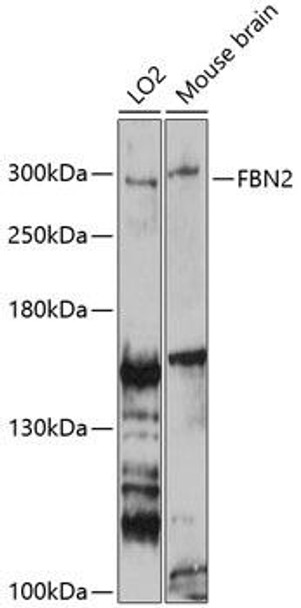 Anti-FBN2 Antibody (CAB9414)