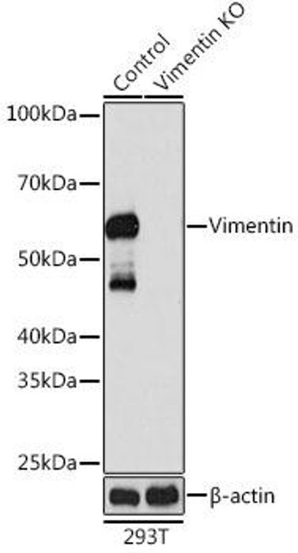 Anti-Vimentin Antibody [KO Validated] (CAB19607)