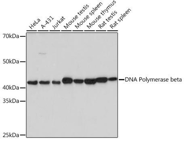 Anti-DNA Polymerase beta Antibody (CAB2412)