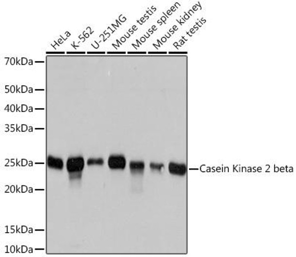 Anti-Casein Kinase 2 beta Antibody (CAB4519)