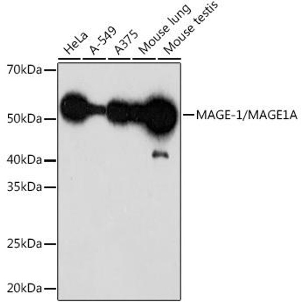 Anti-MAGE-1/MAGE1A Antibody (CAB0723)