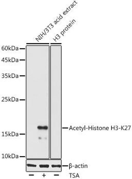 Anti-Acetyl-Histone H3-K27 Antibody (CAB20184)