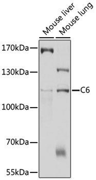Anti-C6 Antibody (CAB10170)