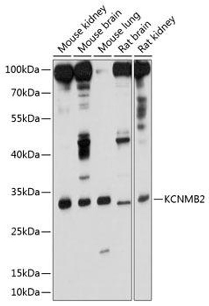 Anti-KCNMB2 Antibody (CAB10277)